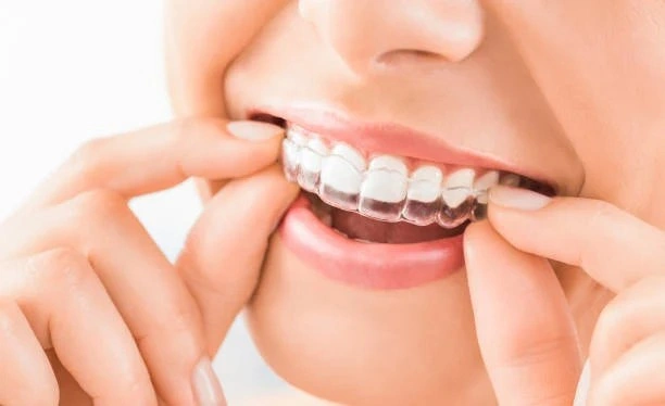Clear Starts Here: How Invisalign Brings Ease to Every Smile